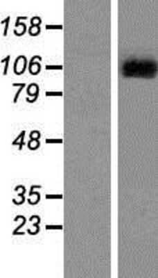 Western Blot: Lgr6 Overexpression Lysate [NBP2-11018]