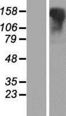 Western Blot: Lgr6 Overexpression Lysate [NBP2-11261]