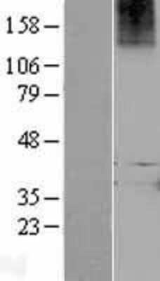 Western Blot: Relaxin R1/LGR7 Overexpression Lysate [NBP2-04387]