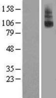 Western Blot: Relaxin R2/LGR8 Overexpression Lysate [NBL1-15638]