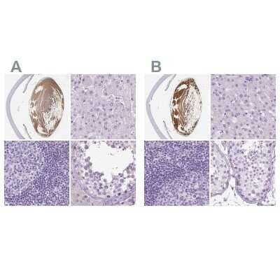 Immunohistochemistry-Paraffin: LGSN Antibody [NBP1-93715]