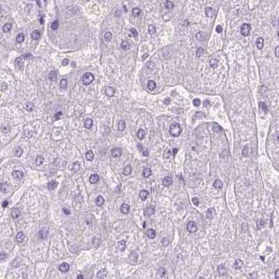 Immunohistochemistry-Paraffin: LGSN Antibody [NBP1-93715]
