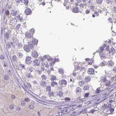 Immunohistochemistry-Paraffin: LGSN Antibody [NBP1-93715]