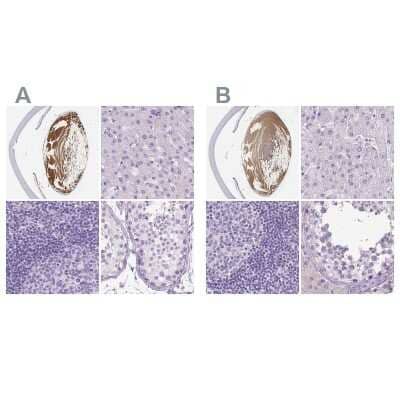 Immunohistochemistry-Paraffin: LGSN Antibody [NBP2-58511]