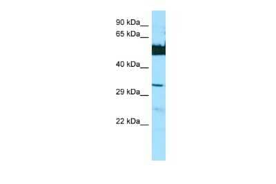 Western Blot: LGSN Antibody [NBP2-85207]