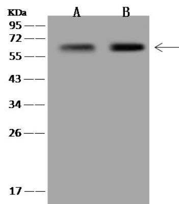 Western Blot: LGSN Antibody [NBP3-12650]