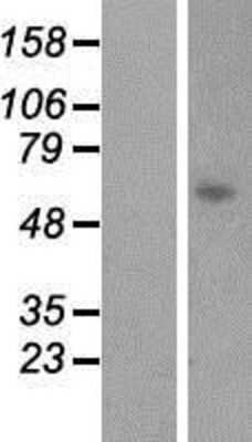 Western Blot: LGSN Overexpression Lysate [NBP2-07012]