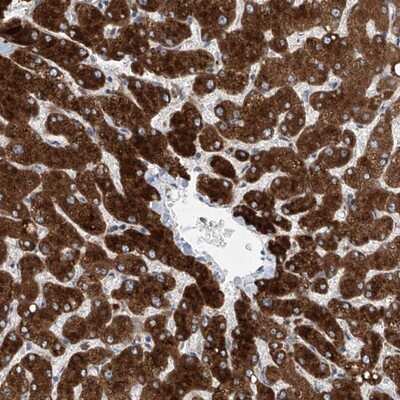 Immunohistochemistry-Paraffin: LGTN Antibody [NBP1-81308]