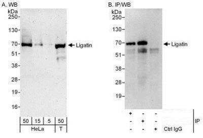 Western Blot: LGTN Antibody [NBP1-50038]