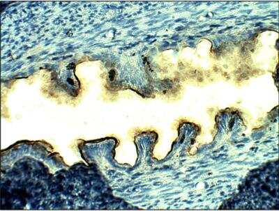 Immunohistochemistry-Paraffin: LH beta Antibody [NBP3-12212]