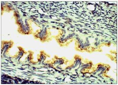 Immunohistochemistry-Paraffin: LH beta Antibody [NBP3-12224]