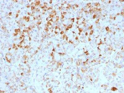 Immunohistochemistry-Paraffin: LH beta Antibody (LHb/1214) [NBP2-45130]