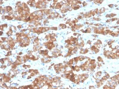 Immunohistochemistry-Paraffin: LH beta Antibody (LHb/1612R) [NBP3-13960]