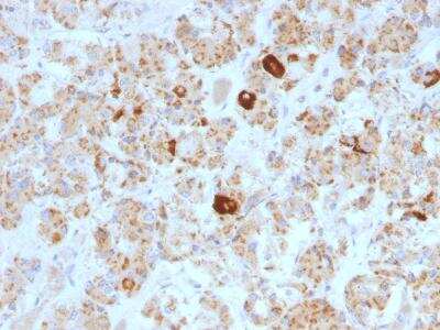 Immunohistochemistry-Paraffin: LH beta Antibody (SPM103) [NBP2-45131]