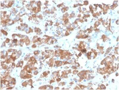 Immunohistochemistry-Paraffin: LH beta Antibody (rLHb/1613) [NBP3-13959]