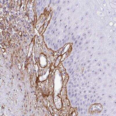Immunohistochemistry-Paraffin: LHFP Antibody [NBP2-31735]