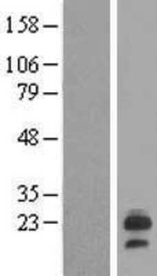 Western Blot: LHFP Overexpression Lysate [NBL1-12511]