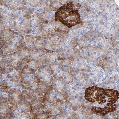 Immunohistochemistry: LHFPL1 Antibody [NBP1-91202]
