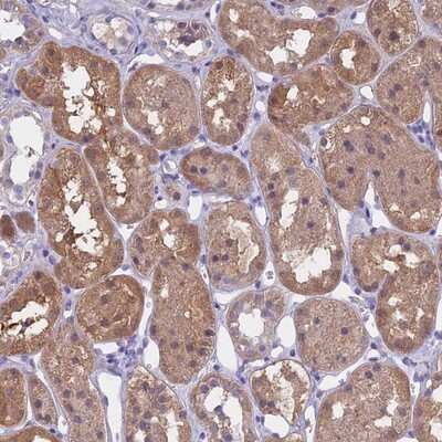 Immunohistochemistry-Paraffin: LHFPL2 Antibody [NBP1-93654]