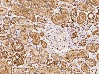 Immunohistochemistry-Paraffin: LHFPL2 Antibody [NBP3-05812]