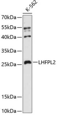 Western Blot: LHFPL2 AntibodyAzide and BSA Free [NBP3-04938]