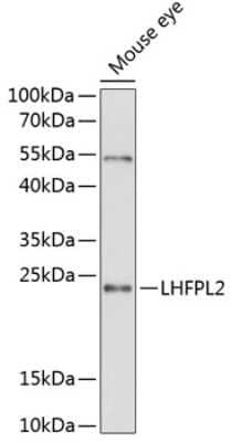 Western Blot: LHFPL2 AntibodyAzide and BSA Free [NBP3-04939]