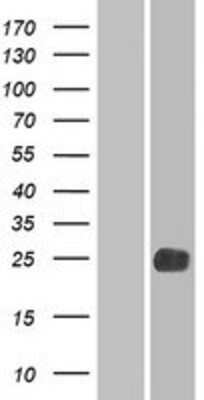 Western Blot: LHFPL2 Overexpression Lysate [NBP2-07702]