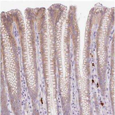 Immunohistochemistry-Paraffin: LHFPL5 Antibody [NBP2-30662]