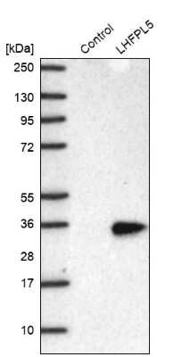 Western Blot: LHFPL5 Antibody [NBP2-30662]