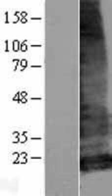 Western Blot: LHFPL5 Overexpression Lysate [NBP2-04852]