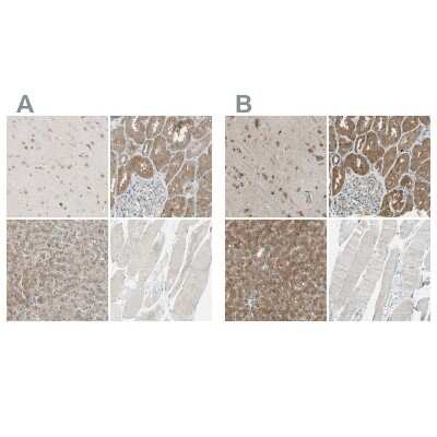 Immunohistochemistry-Paraffin: LHPP Antibody [NBP1-83272]