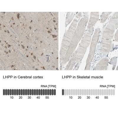 Immunohistochemistry-Paraffin: LHPP Antibody [NBP1-83273]