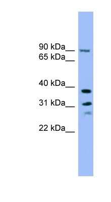 Western Blot: LHPP Antibody [NBP1-70600]