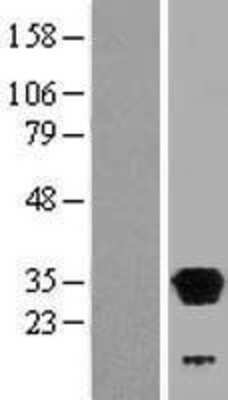 Western Blot: LHPP Overexpression Lysate [NBP2-06465]