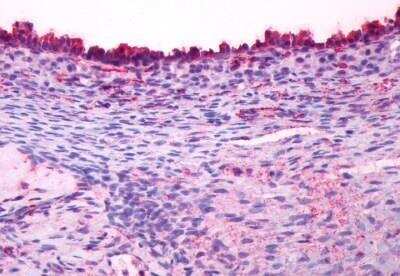 Immunohistochemistry-Paraffin: LHR Antibody - BSA Free [NLS1436]
