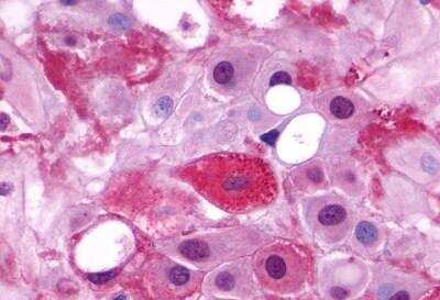 Immunohistochemistry-Paraffin: LHR Antibody - BSA Free [NLS1436]