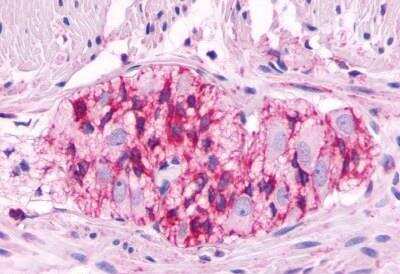Immunohistochemistry-Paraffin: LHR Antibody - BSA Free [NLS1436]