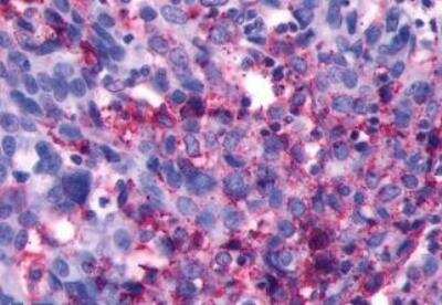Immunohistochemistry-Paraffin: LHR Antibody - BSA Free [NLS1436]