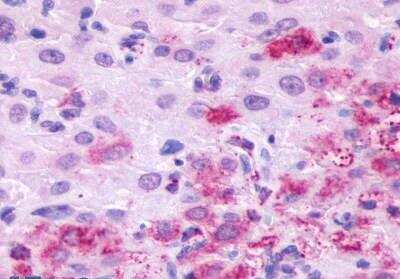 Immunohistochemistry-Paraffin: LHR Antibody - BSA Free [NLS1436]