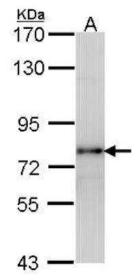 Western Blot: LHR Antibody [NBP2-53094]