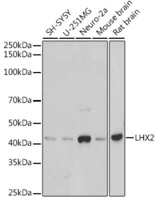 Western Blot: LHX2 Antibody (6G9K2) [NBP3-15725]