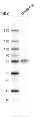 Western Blot: LHX2 Antibody (CL6137) [NBP2-61435]