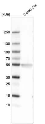 Western Blot: LHX2 Antibody (CL6137) [NBP2-61435]