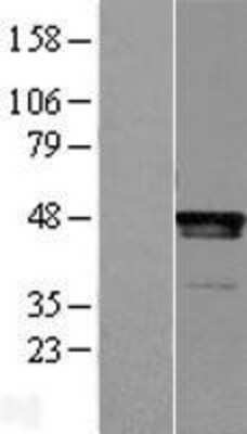 Western Blot: LHX2 Overexpression Lysate [NBL1-12514]