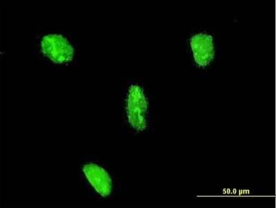 Immunocytochemistry/ Immunofluorescence: LHX3 Antibody (2C10) [H00008022-M08]