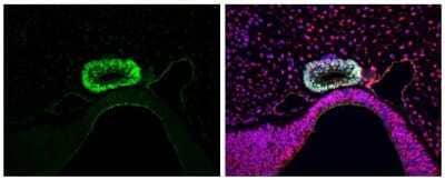 Immunohistochemistry-Paraffin: LHX3 Antibody [NBP3-13352]