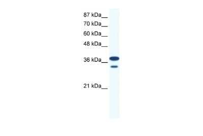 Western Blot: LHX3 Antibody [NBP2-84132]