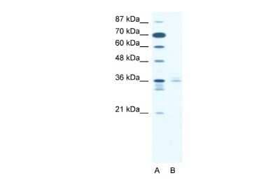 Western Blot: LHX3 Antibody [NBP2-84133]