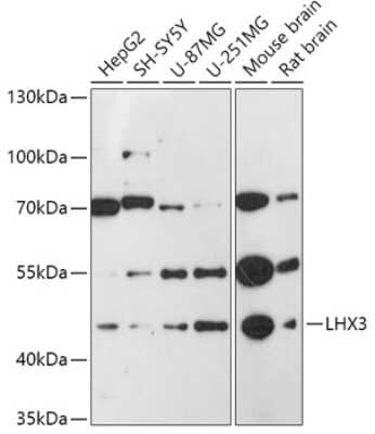 Western Blot: LHX3 AntibodyAzide and BSA Free [NBP3-03943]