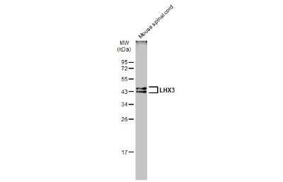 Western Blot: LHX3 Antibody [NBP3-13352]